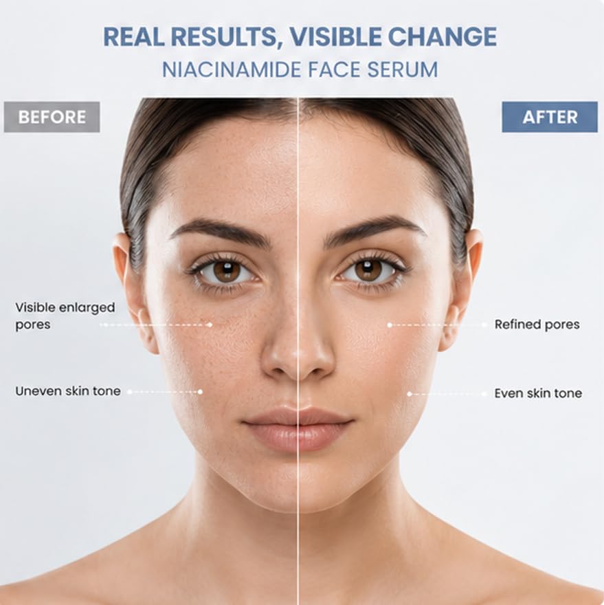 ANTOLOGIA Niacinamide Face Serum with Vitamin B3 for Oily Combination and Blemish Prone Skin Helps Improve Skin Tone Supports Smoother Looking Skin 30 ml