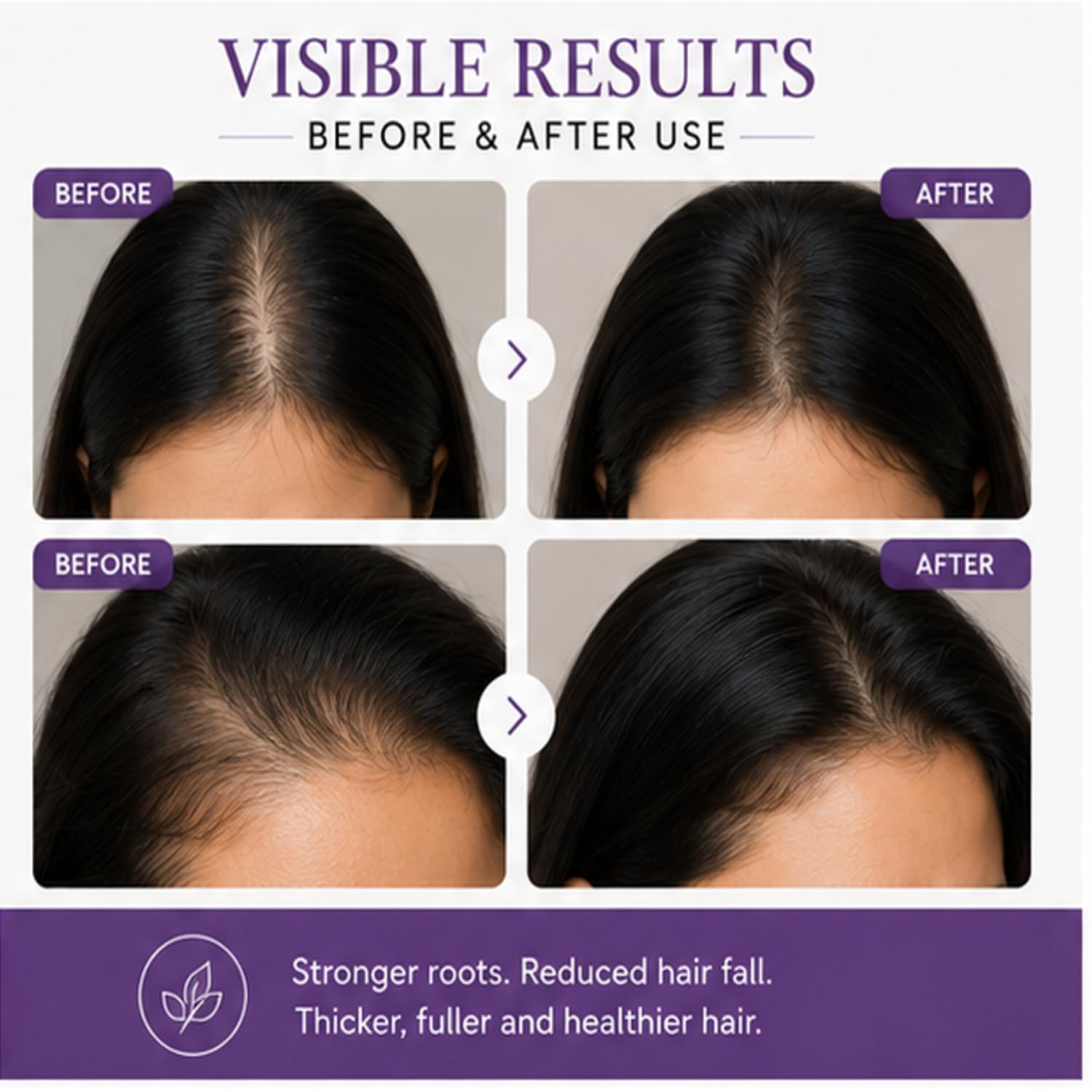Antologia Rosemary Hair Serum for Hair Fall Control & Scalp Nourishment, Lightweight Hair Care Serum for Stronger and Healthier Looking Hair, 30ml