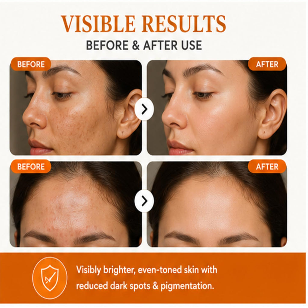 Antologia Vitamin C 10% Serum for Hyperpigmentation & Dull Skin, Brightening Facial Serum for Even Tone & Radiant Looking Skin, Lightweight Formula, 30ml