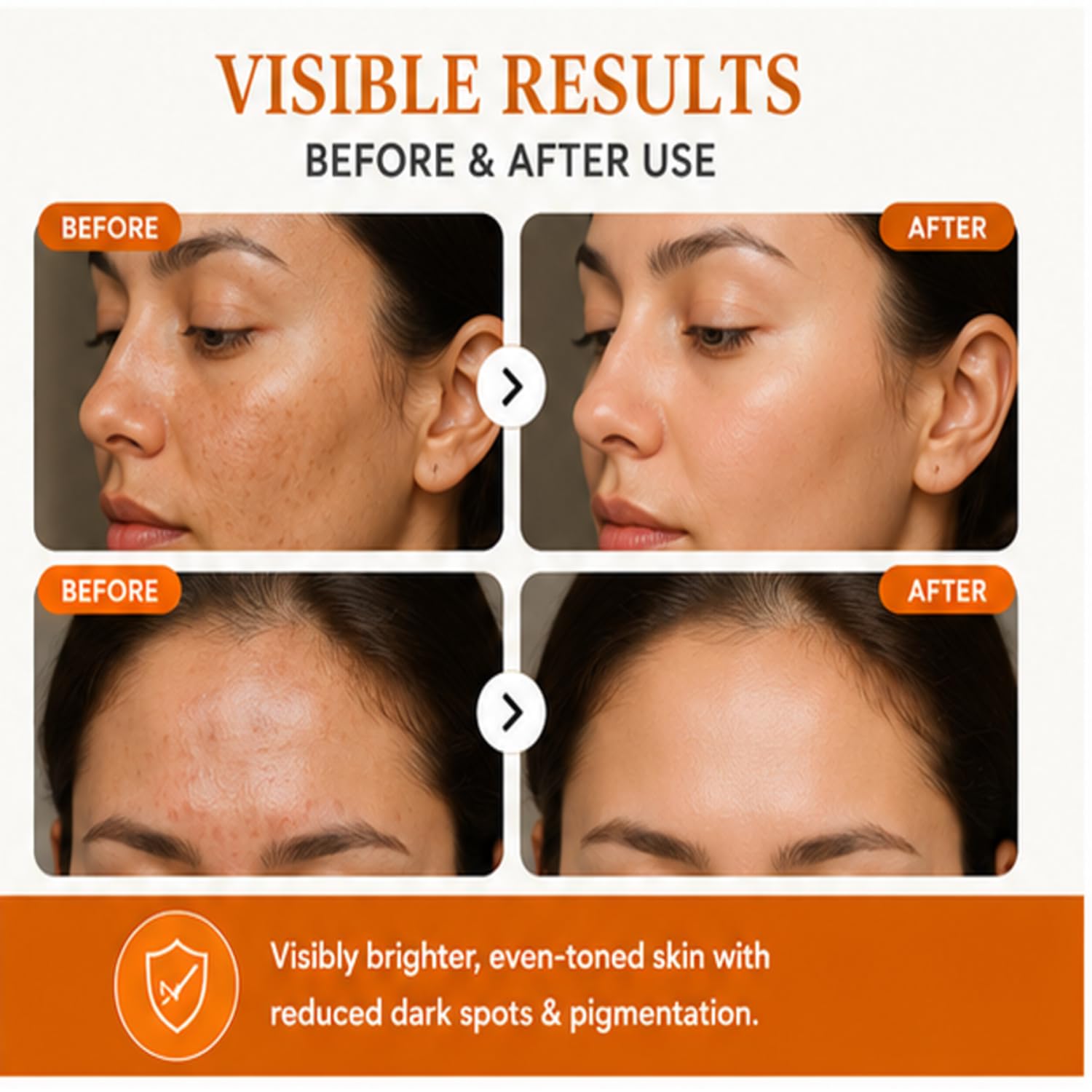 Antologia Vitamin C 10% Serum for Hyperpigmentation & Dull Skin, Brightening Facial Serum for Even Tone & Radiant Looking Skin, Lightweight Formula, 30ml