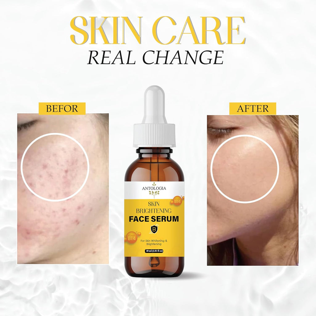 Antologia Skin Brightening Face Serum with Vitamin B14, 30 ml, Whitening Formula