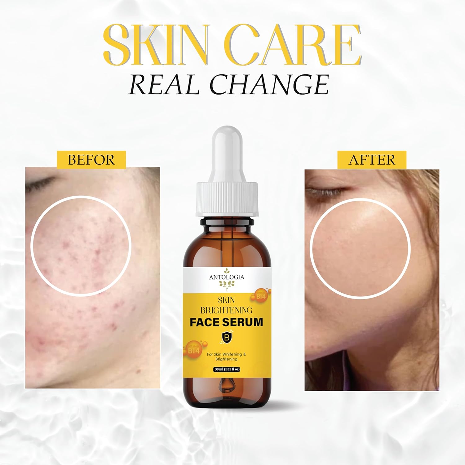 Antologia Skin Brightening Face Serum with Vitamin B14, 30 ml, Whitening Formula