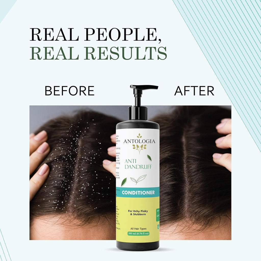 Antologia Conditioner, Nourishing, Repairing, Smoothening, All Hair Types, 200ml (Anti Dandruff Conditioner)