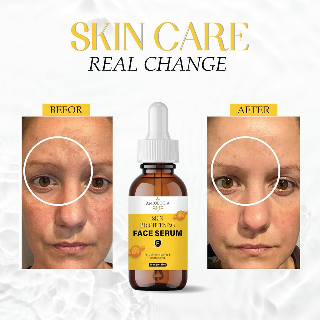 Antologia Skin Brightening Face Serum with Vitamin B14, 30 ml, Whitening Formula