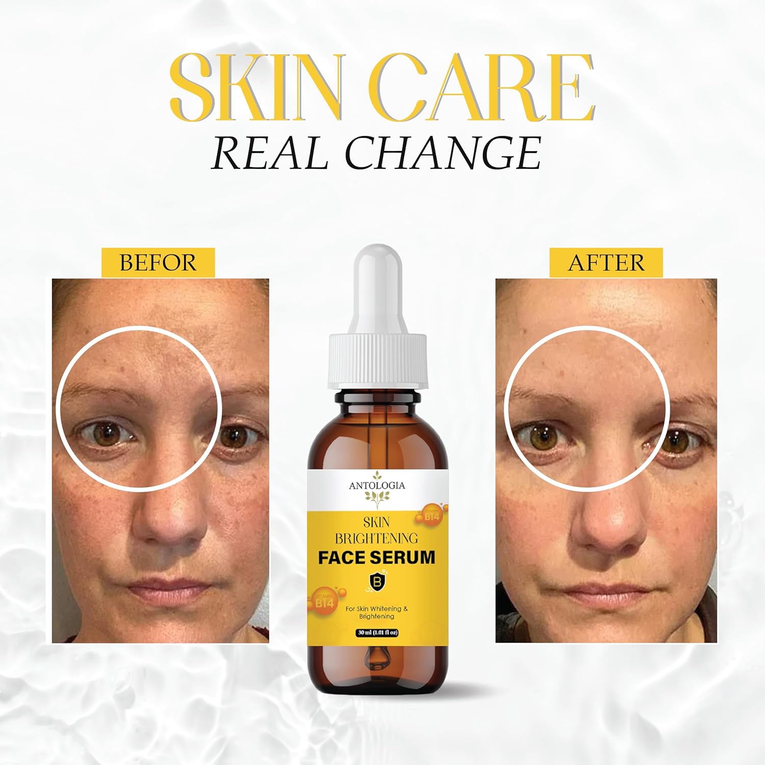 Antologia Skin Brightening Face Serum with Vitamin B14, 30 ml, Whitening Formula