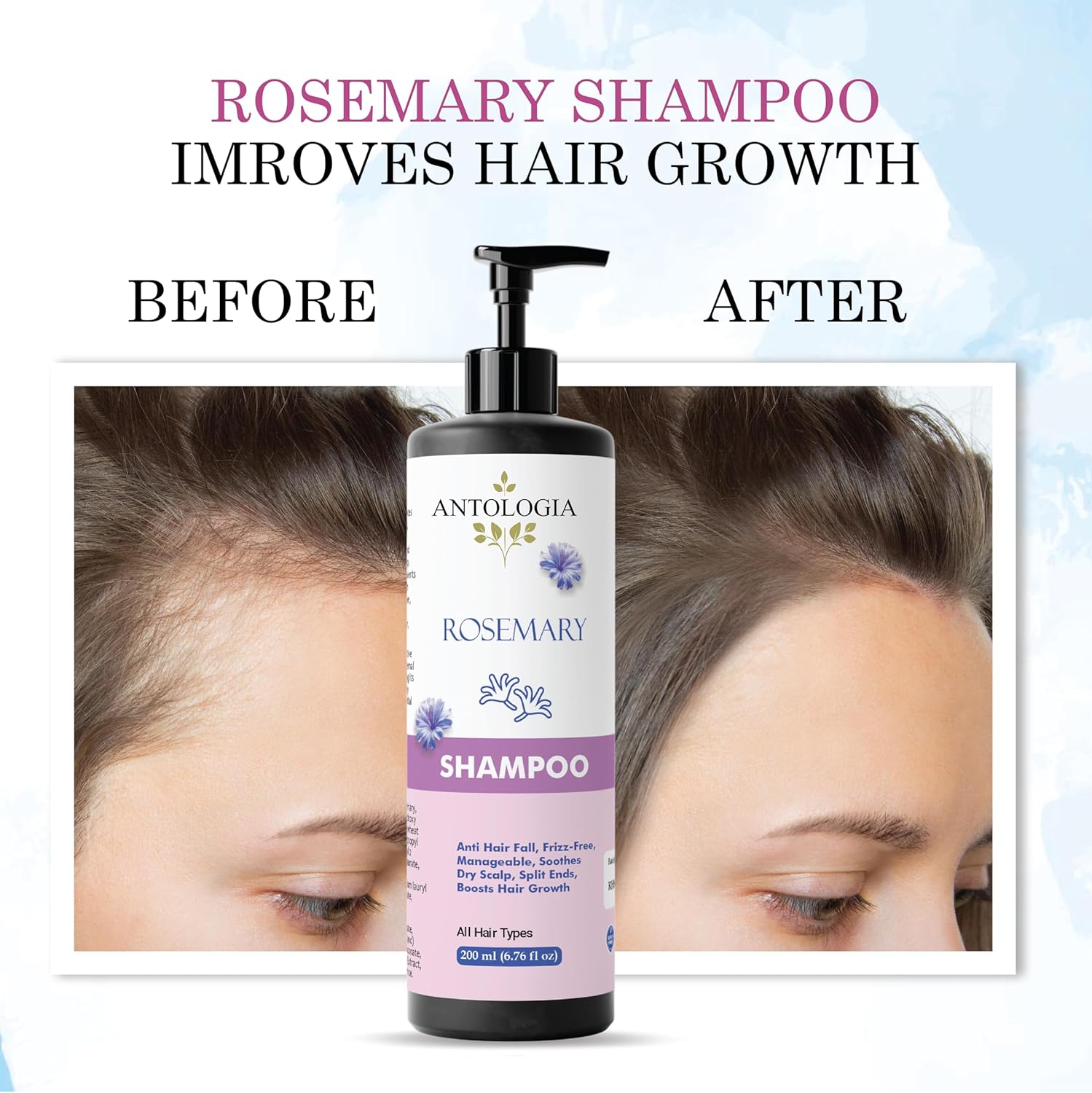 Antologia Rosemary Shampoo, Anti Hair Fall, Frizz-Free, Boosts Hair Growth, All Hair Types, 200ml