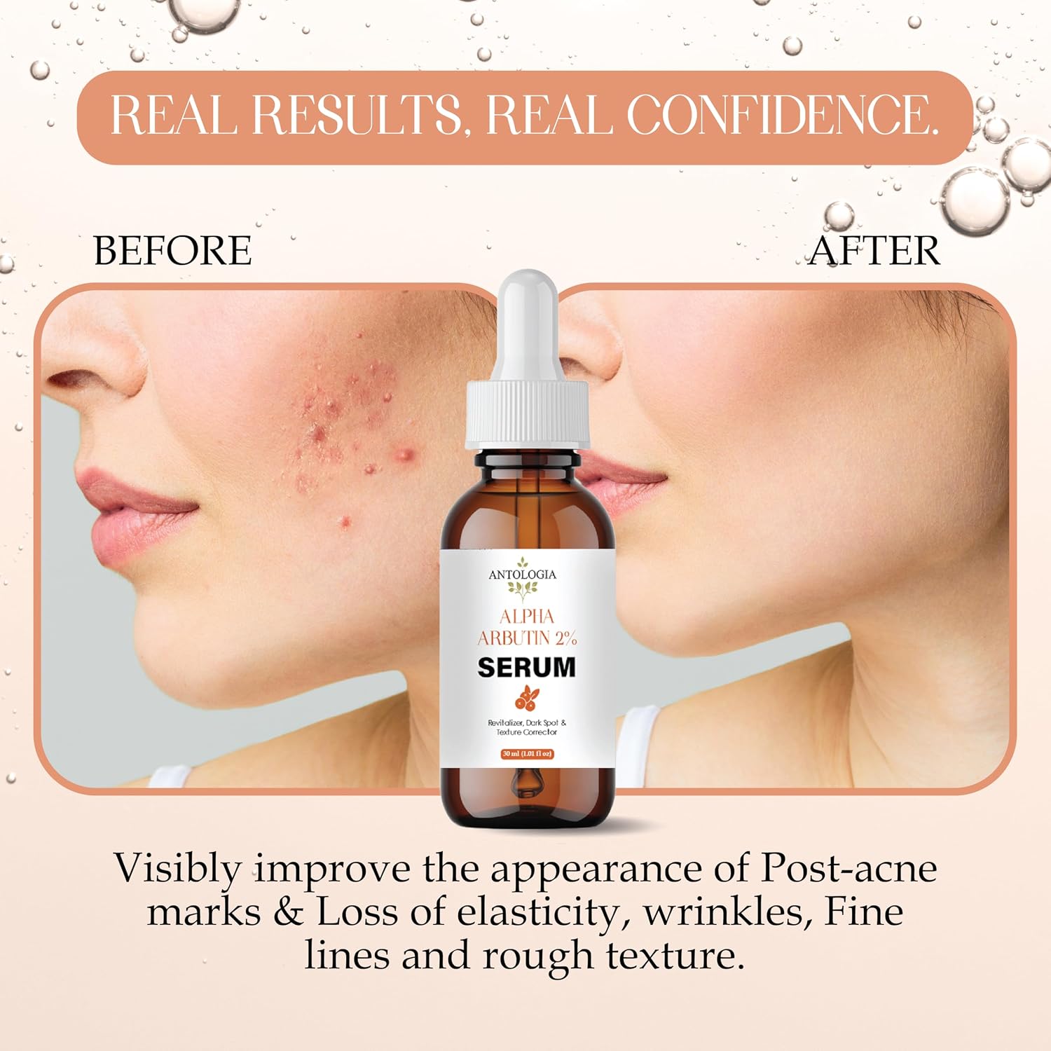 Antologia Alpha Arbutin 2% Serum, Dark Spot and Texture Corrector, 30 ml